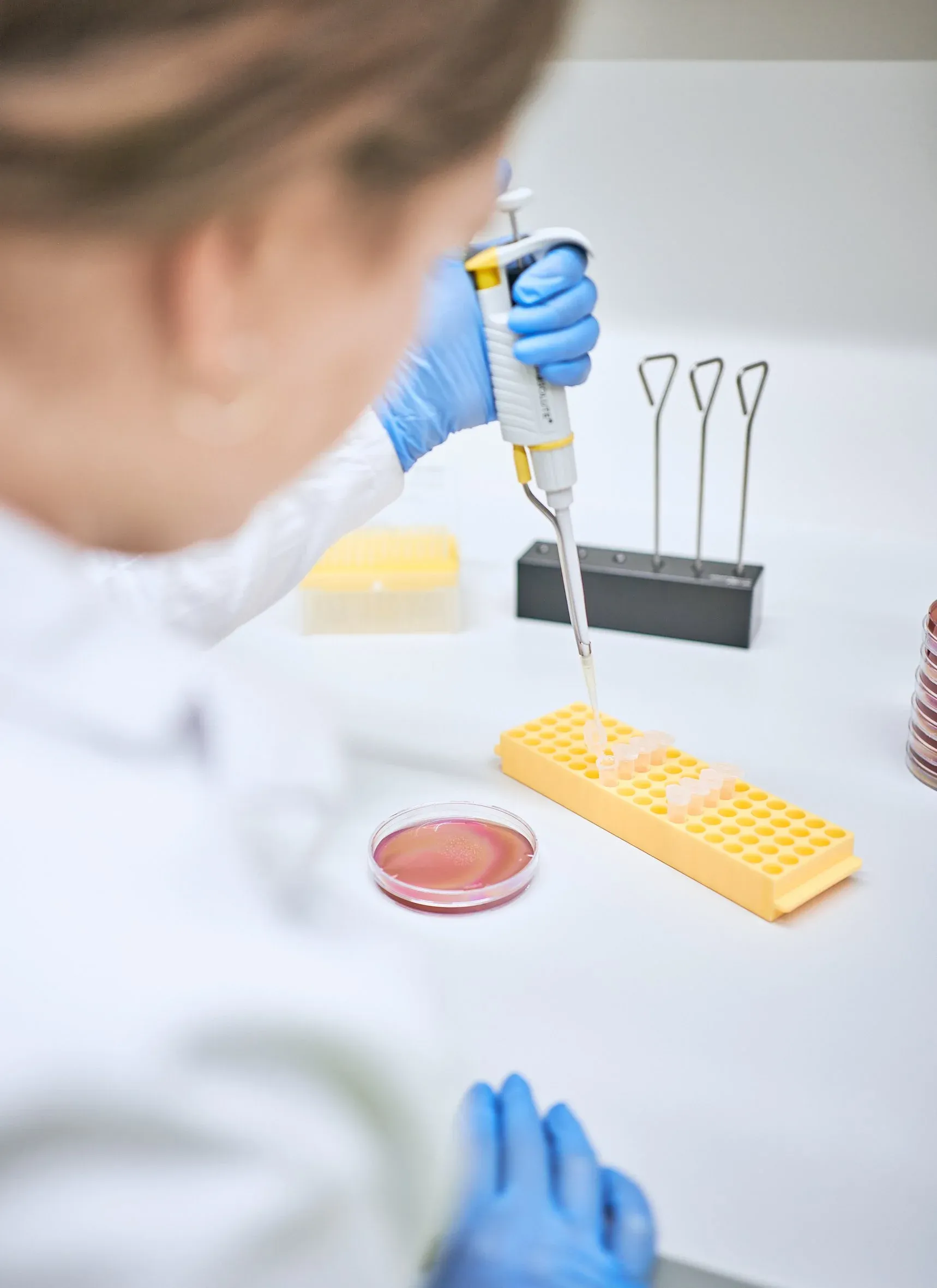 Laborantin pipettiert mit blauen Handschuhen Proben in ein gelbes Reagenzröhrchen-Rack, Petrischale daneben